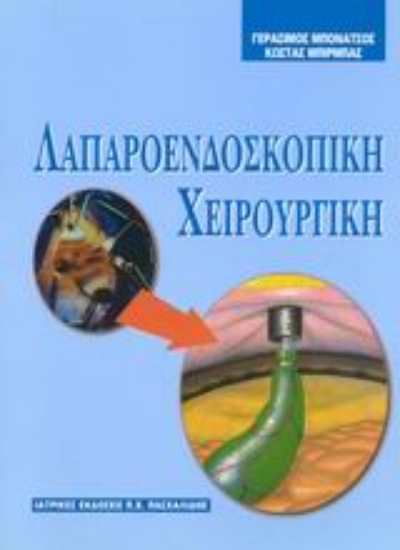 Εικόνα Λαπαροενδοσκοπική χειρουργική