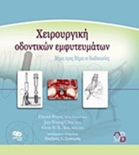 Εικόνα Χειρουργική οδοντικών εμφυτευμάτων