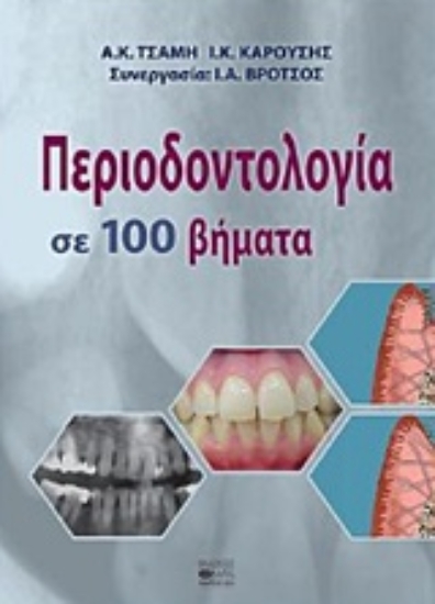 227613 - Περιοδοντολογία σε 100 βήματα