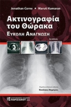 Εικόνα Ακτινογραφία του θώρακα