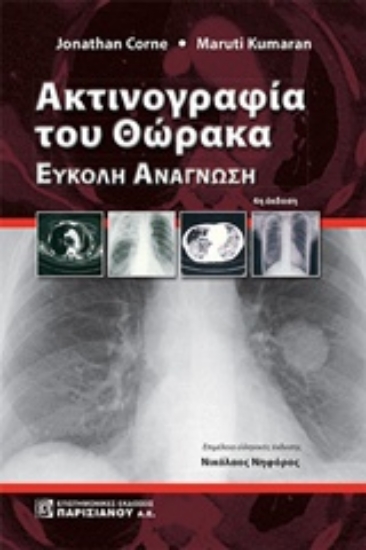 Εικόνα Ακτινογραφία του θώρακα