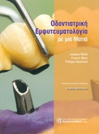 Εικόνα Οδοντιατρική εμφυτευματολογία