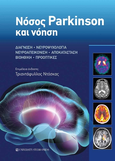 299299-Νόσος Parkinson και νόηση